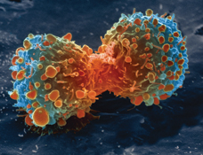 Lung cancer cell undergoing division. Photo By United States: National Institutes of Health [Public domain], via Wikimedia Commons